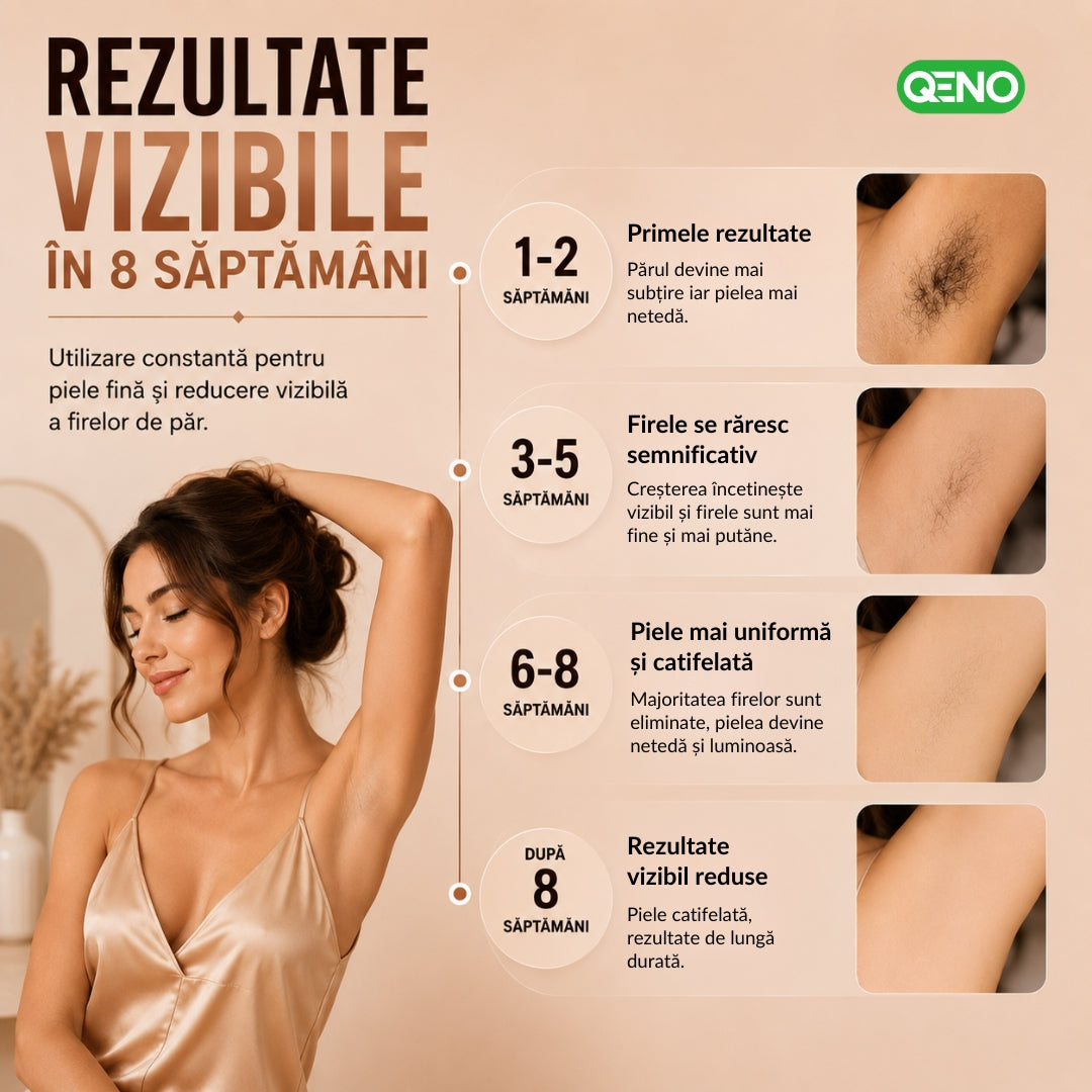 Epilator IPL QENO® EPILOME, 999.900 Impulsuri