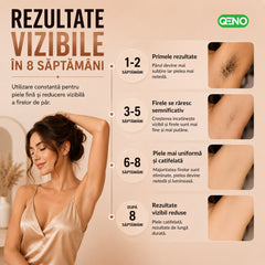 Epilator IPL QENO® EPILOME, 999.900 Impulsuri — poza 12