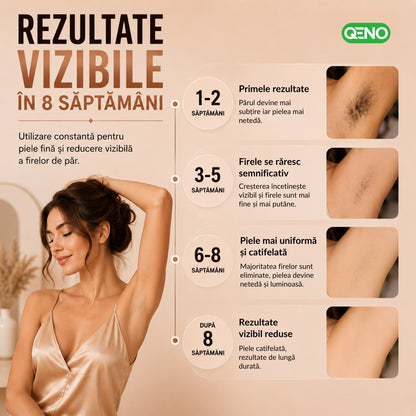 Epilator IPL QENO® EPILOME, 999.900 Impulsuri
